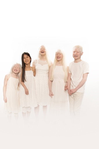 Born with Albinism