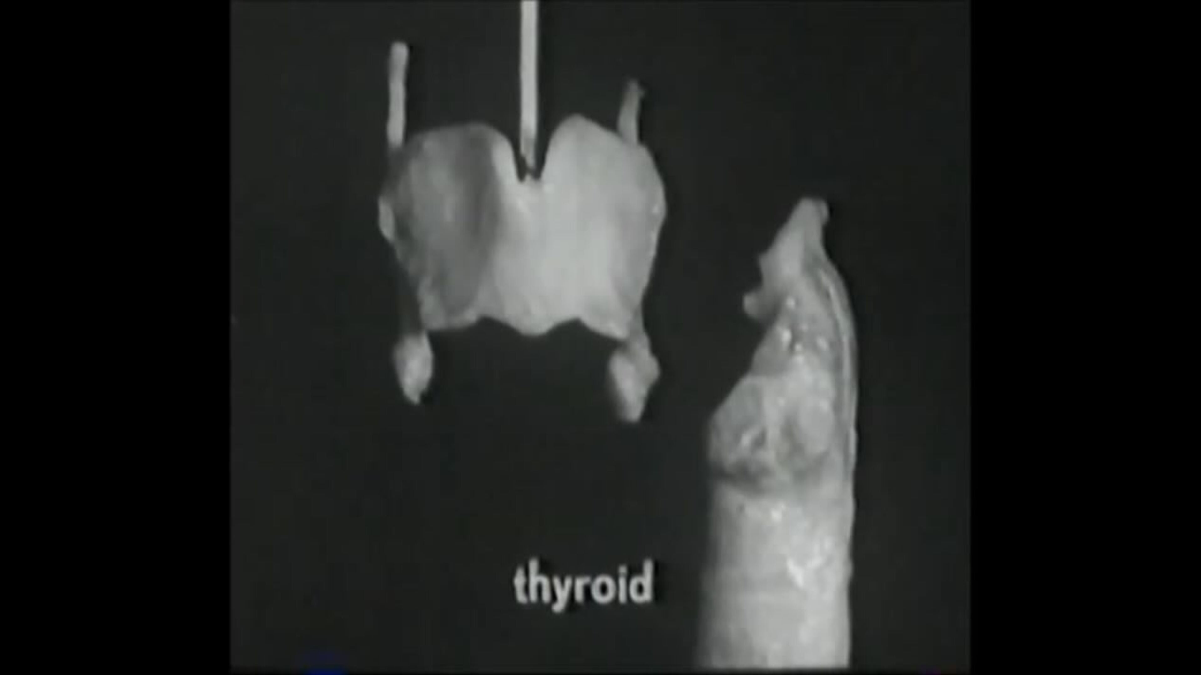 Voice Production: The Vibrating Larynx