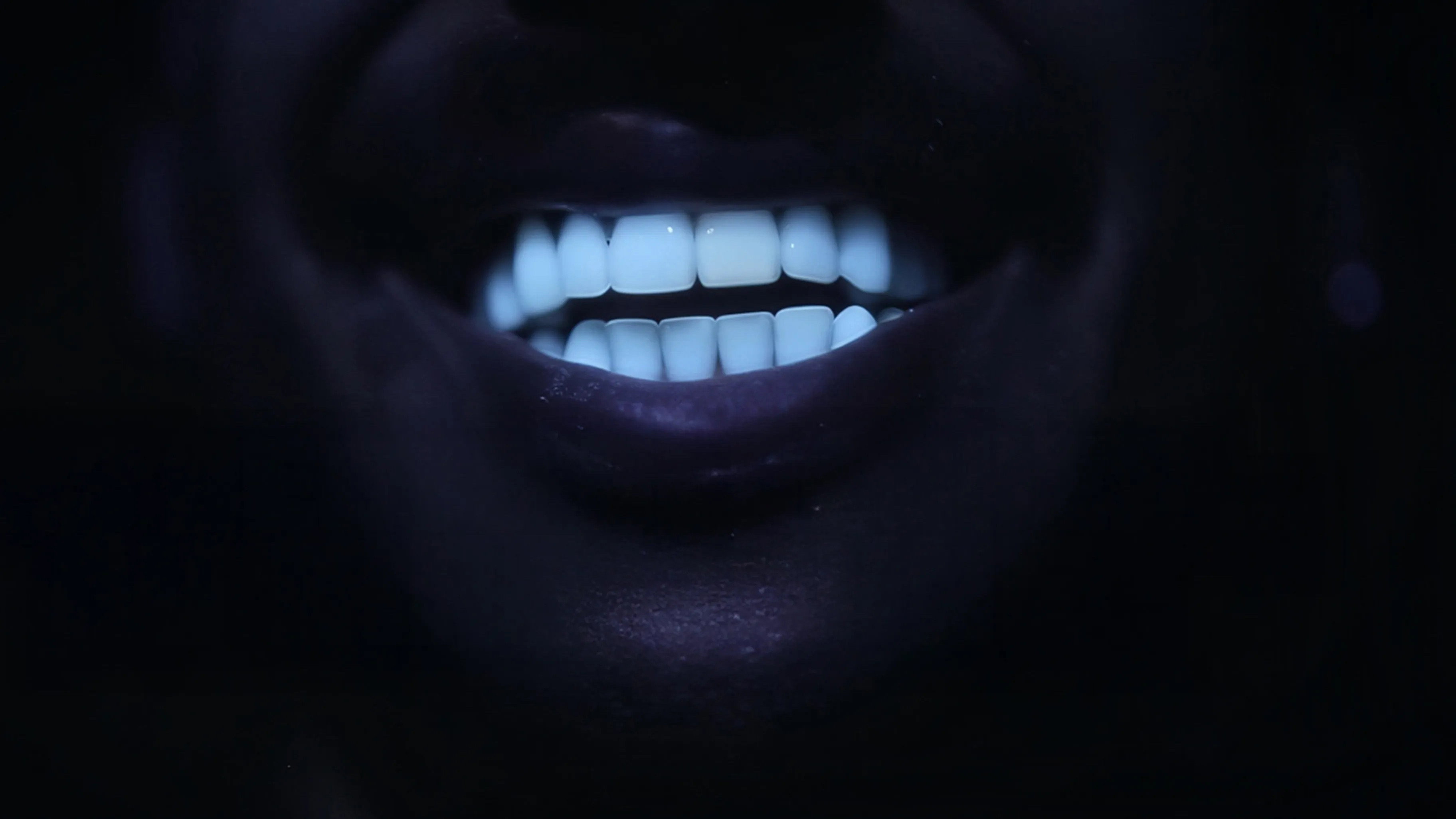 Des dents blanches... au rire jaune !